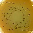 Hektoen Enteric Medium