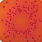 MacConkey Agar (with salt)