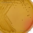 Mannitol Salt Agar